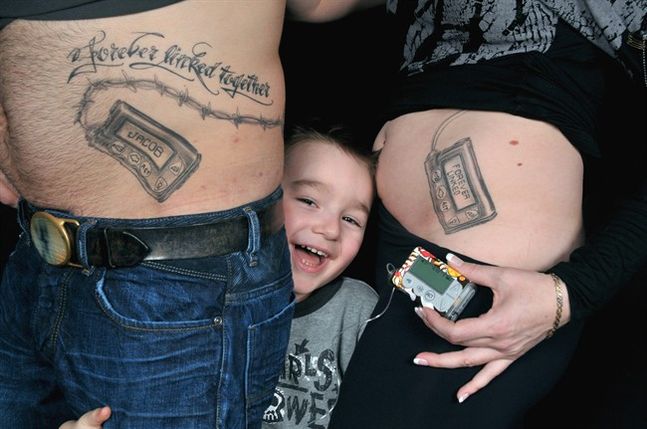 Parents Get Insulin-Pump Tattoos To Support Diabetic Child