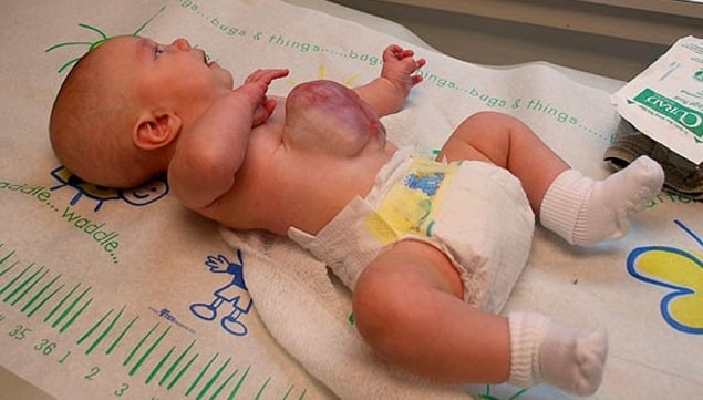 tex baby organs outside body