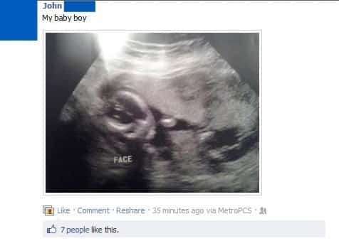STFU Parents: Are Ultrasound Photos Still Even Considered Facebook Overshare?