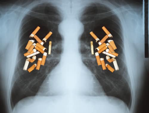 Fewer Kids Are Forfeiting Their Lungs To Cancer