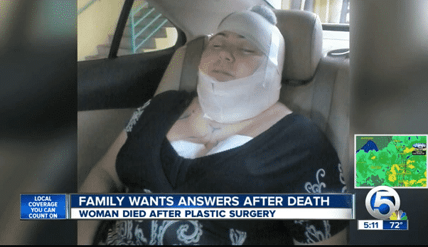 Mother Dies After Extensive Plastic Surgery The Press Has Dubbed A ‘Mommy Makeover’