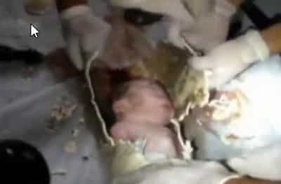 Newborn Saved From Sewer Pipe After Mom Allegedly Gives Birth Over Toilet And I Blame The One-Child Policy
