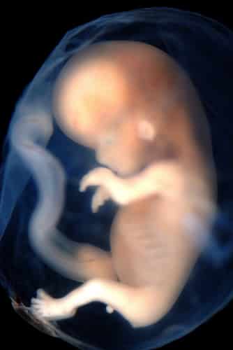Morning Feeding: Does Your Fetus Have More Rights Than You Do?