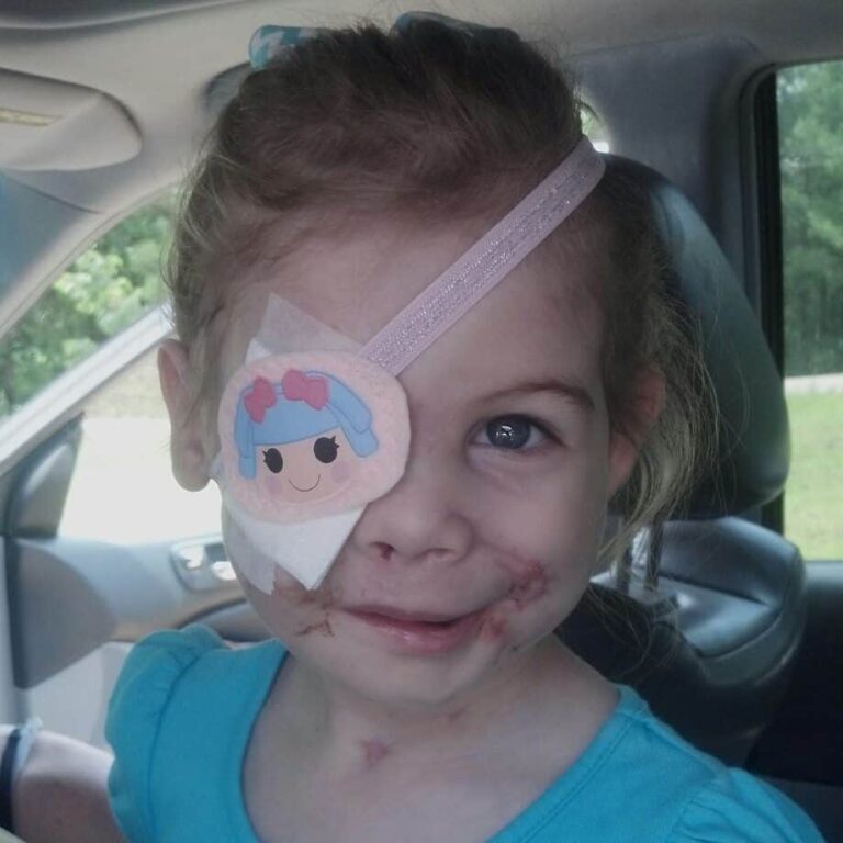 3-Year-Old Pit Bull Attack Survivor Forced To Leave KFC Because Her Scars Were ‘Disruptive’ And People Are Awful