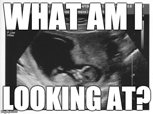 The Only Person Who Wants To See Your Ultrasound Picture Is Your Mom