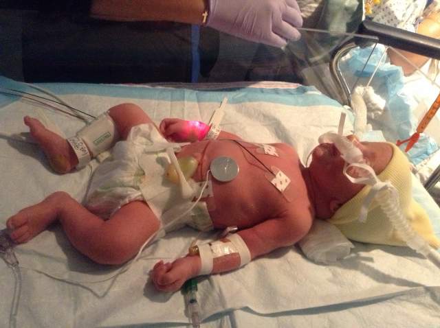 5 Things I Wish I Had Known About Having A Baby In The NICU