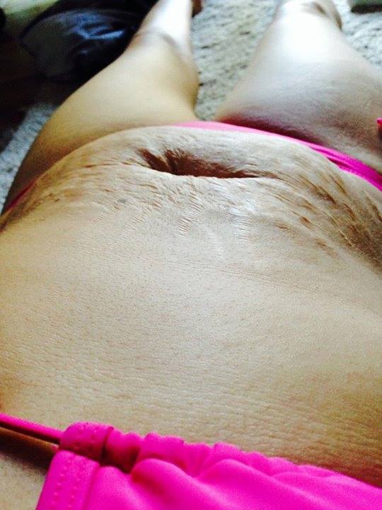 This Mom’s Rant For Being Shamed For Her Stretch Marks In A Bikini Is Perfect