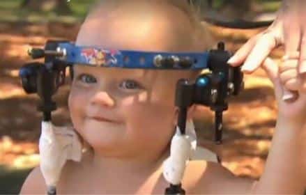 Amazing Doctors Reattached This Toddler’s Head After He Was Internally Decapitated