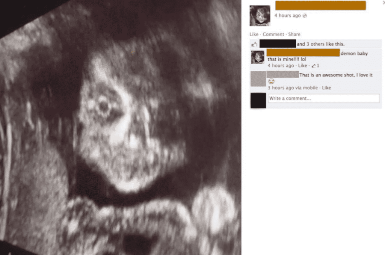 STFU Parents: Creepy Ultrasound Images That Capture The Spirit Of Halloween