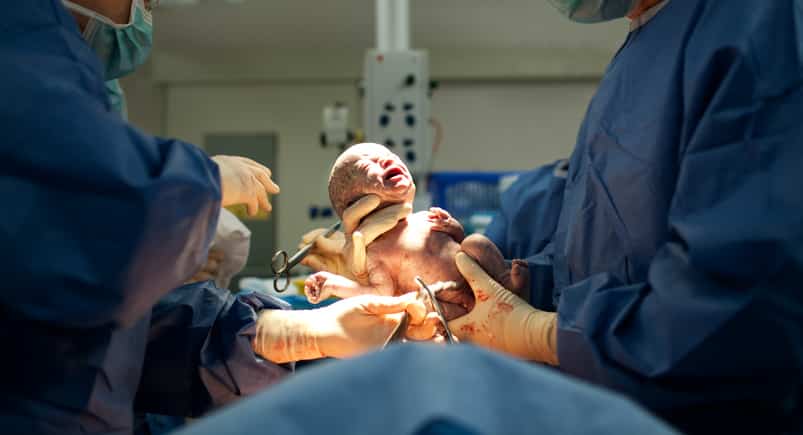 forced c-section