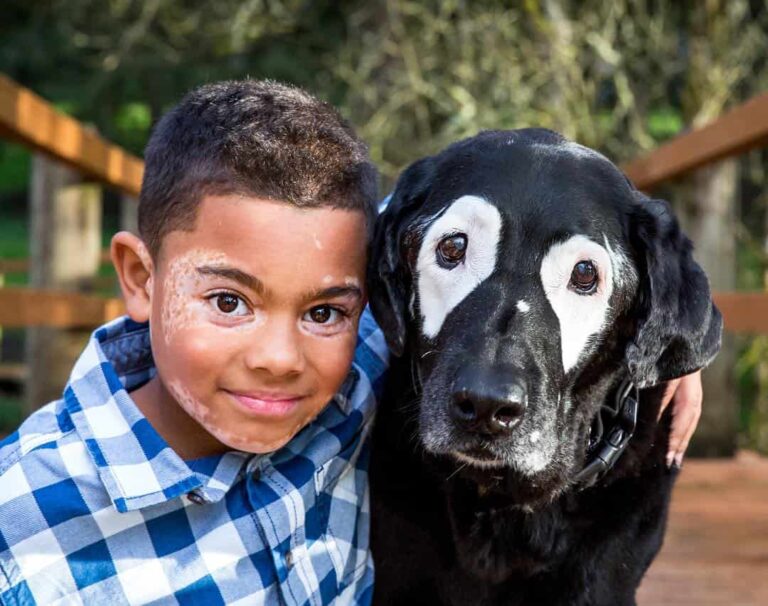 Boy With Vitiligo Meets Adorable Dog with Same Condition