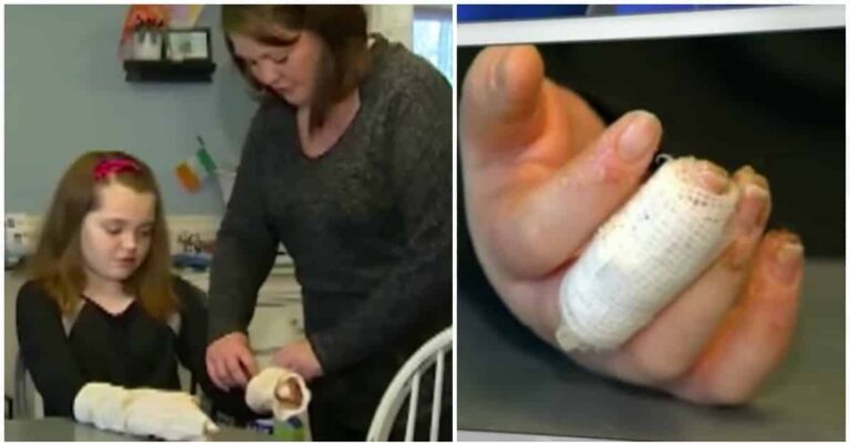Mother Warns that Popular Ingredient in Homemade Slime Causes Third Degree Burns
