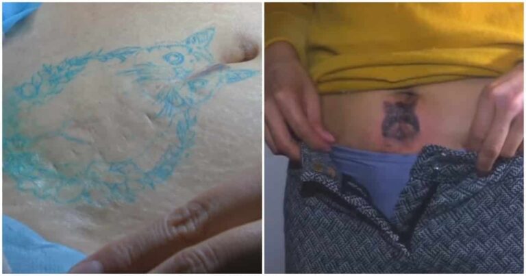 Woman Now Seeking Tattoos as the Perfect Cover-Ups for C-Section Scars