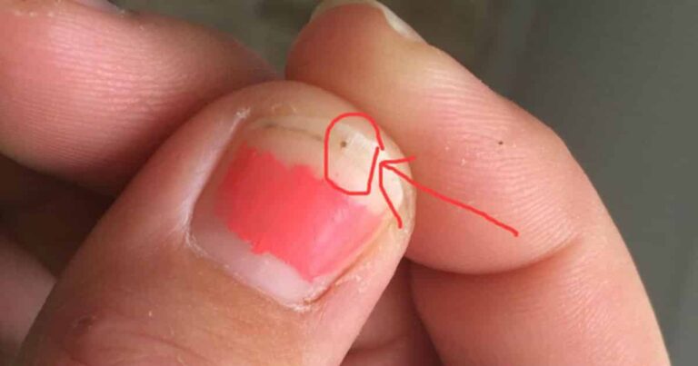 This Mom’s Viral Photo About ‘Seed Ticks’ Is Important for All Parents to See