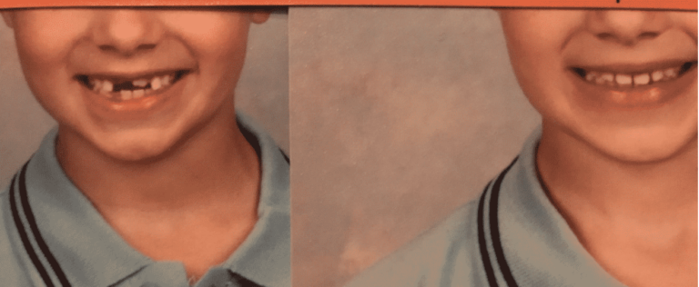 Mom Stunned When Her Son’s School Photos Are Digitally Altered