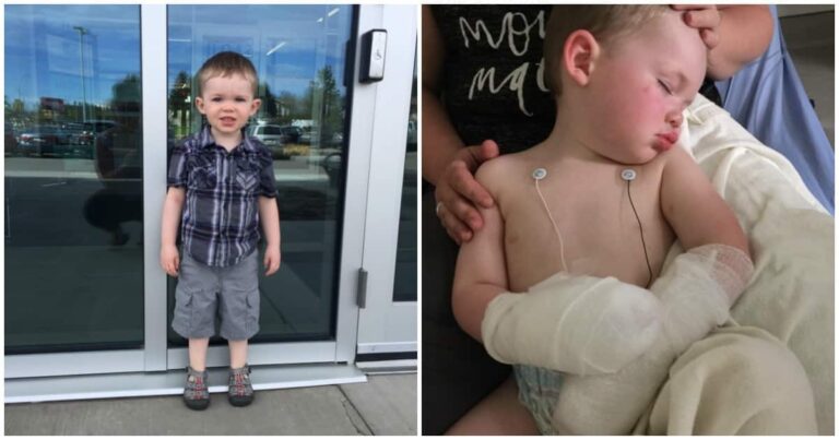 Toddler Suffers Traumatic Burns After Falling Into Extinguished Fire Pit