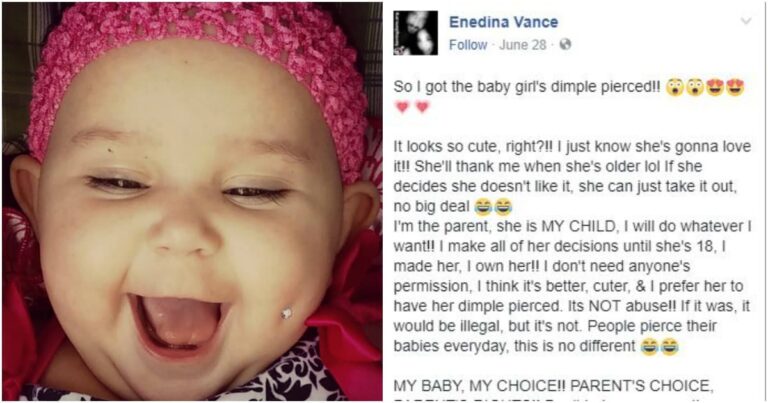 Mom Posts Photo of Baby’s ‘Pierced’ Cheek and the Internet Went Off