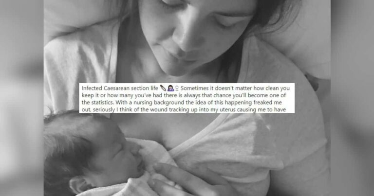 Mom Fires Back at People Who Say C-Sections Are the ‘Easy Way Out’ in Viral Instagram Post