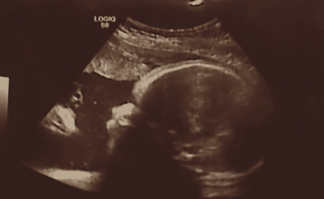 do you see jesus in the ultrasound?