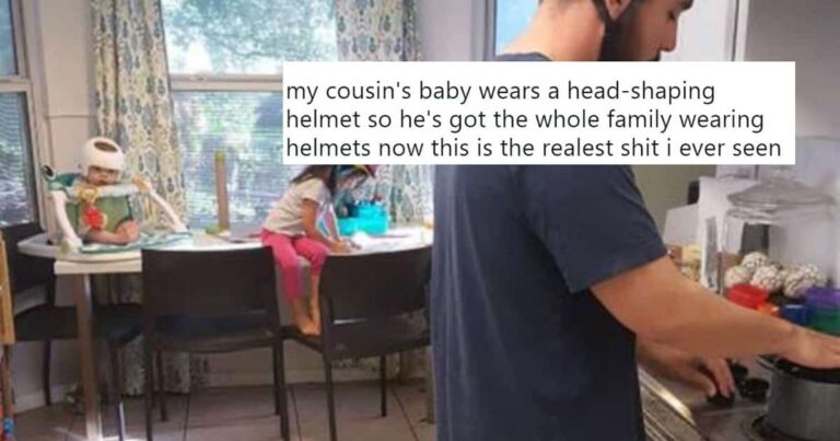 This Baby Needs to Wear Corrective Helmet, His Family Supports Him in the Cutest Way