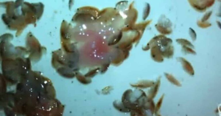 These Tiny, Freaky Sea Creatures Ate the Skin Off a Teenager’s Legs in the Ocean