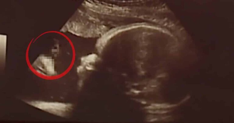 Parents See the ‘Face of Jesus’ in Their Baby’s Ultrasound