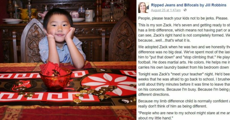Mom of Son With Special Needs Asks Parents to Teach Kids ‘Not to Be Jerks’ in Viral Post