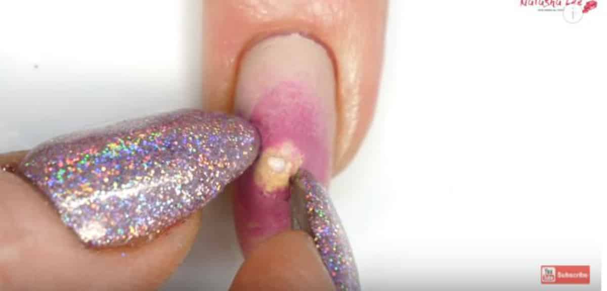 pimple popping nail art