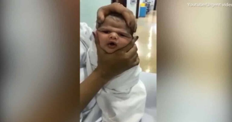 Three Nurses Fired After They Squished a Baby’s Face