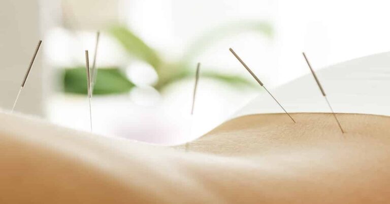 New Study Finds No Benefit of Acupuncture During IVF Treatments
