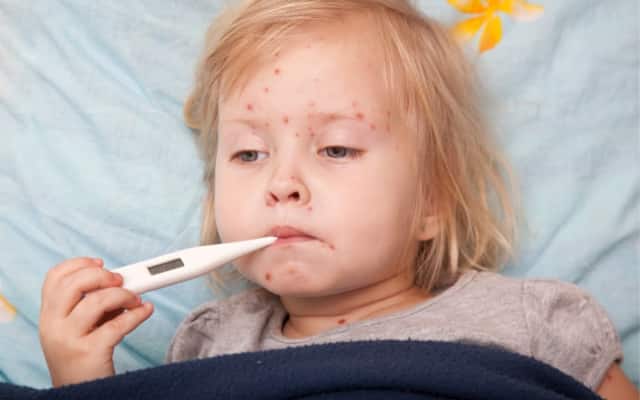 Parents Are Hosting ‘Chicken Pox Parties’ To Get Their Kids Sick Instead Of Vaccinated