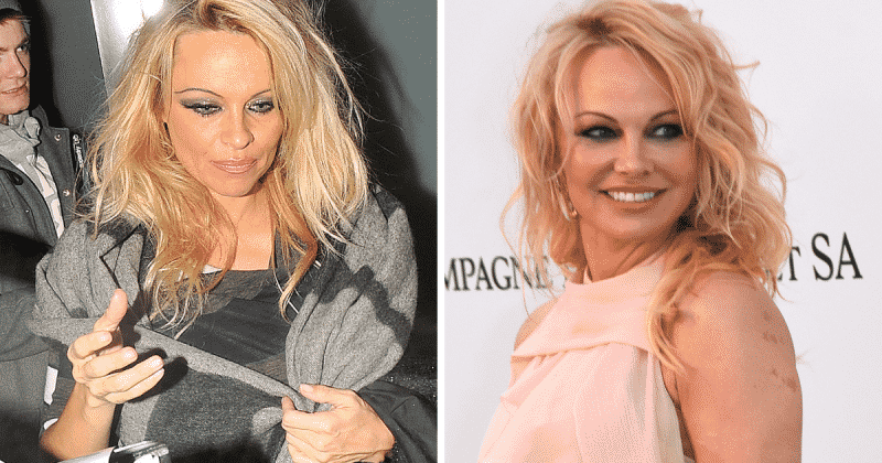 40 Celebrities Who Look Completely Different After Plastic Surgery ...